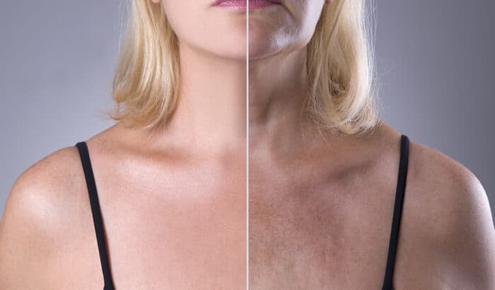 Dekolleté Lifting Duo – Bild 3