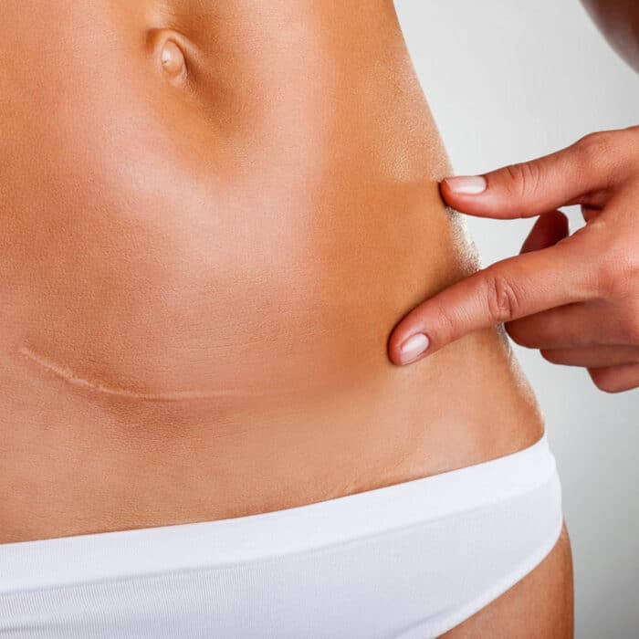 Weizenkeim Öl Pfirsich 100ml – Bild 3